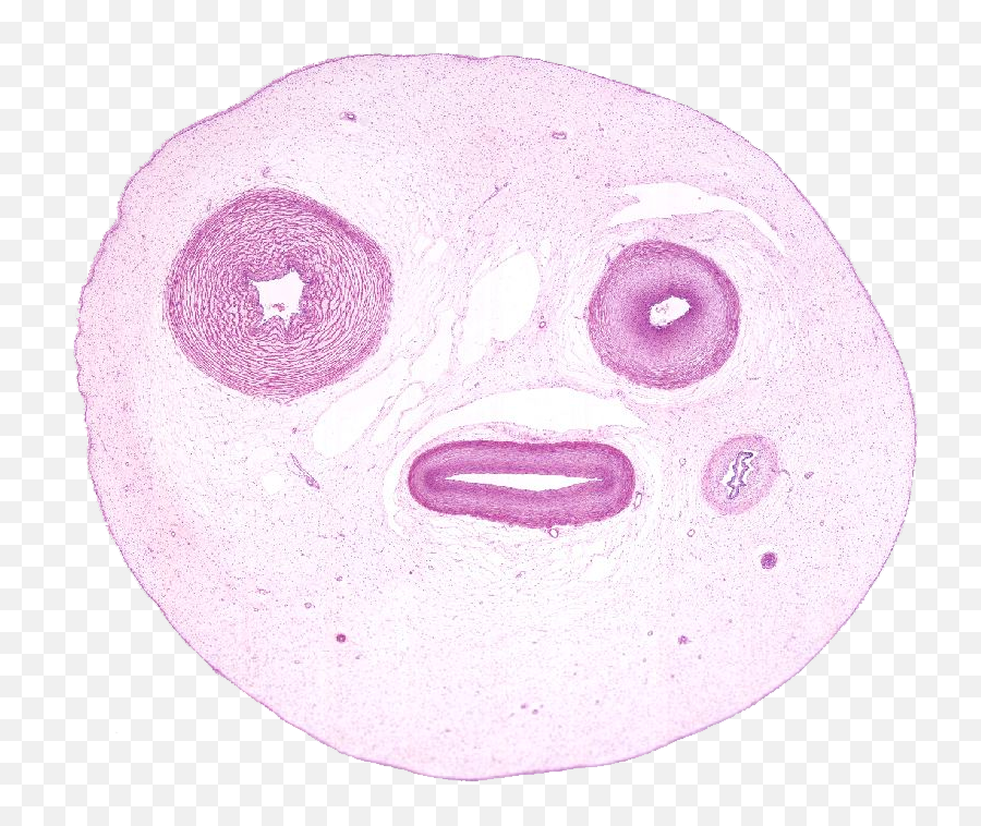 Module 54 Structures Of Pregnancy U2014 Hawkeye Histology - Jelly Umbilical Cord Histology Png,Laso Icon