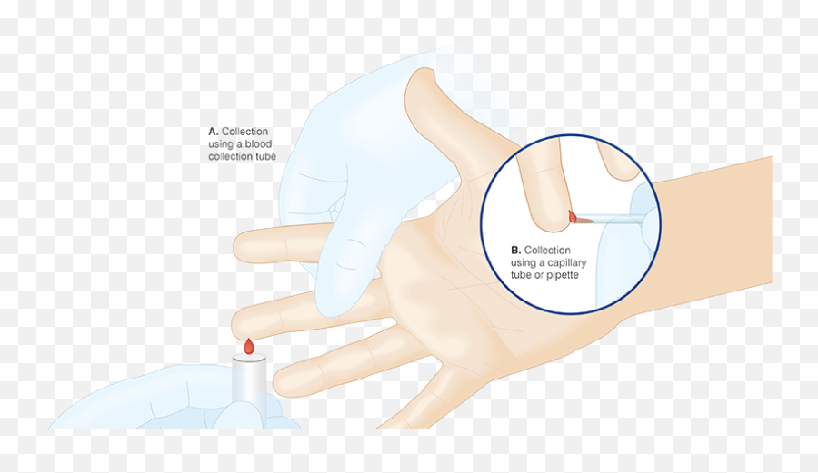 Collecting A Finger Capillary Blood Sample - Owen Mumford Blood Collection By Capillary Method Png,Blood Hand Png