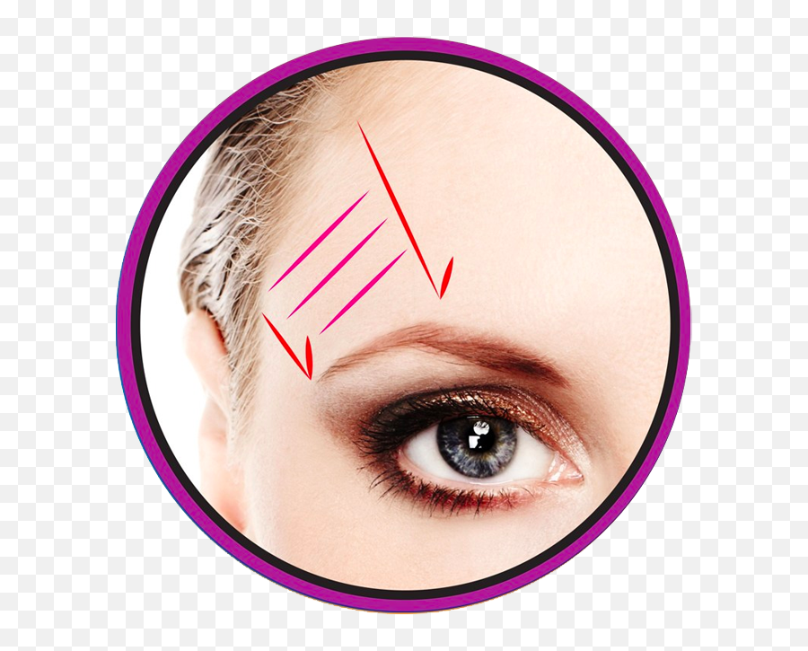 Pdo Threading Barcode Lift Eyebrow Glabella - Hot Springs Surgery And Vein Clinic Png,Eyebrow Png