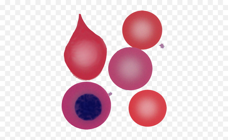 Teardrop Cells - Wwwhaematologyetccouk Dot Png,Tear Drop Png