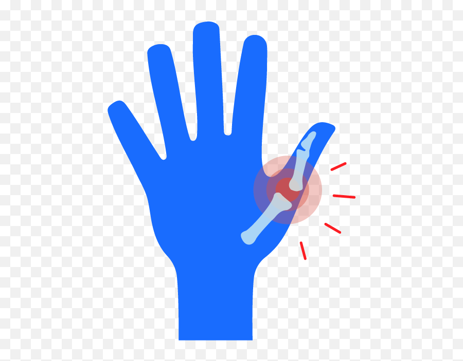 Sprained Thumb When To See A Doctor U0026 Tips For Recovery Buoy - Language Png,Punching Fist Icon