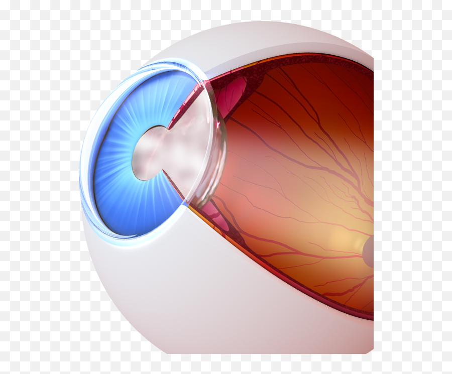 Laser Cataract Surgery U2013 New Jersey Dr Kenneth S Miller - Surgery Cataract Png,Laser Eyes Png