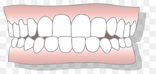 Underbite Correction Treatment Options - Canine Tooth png