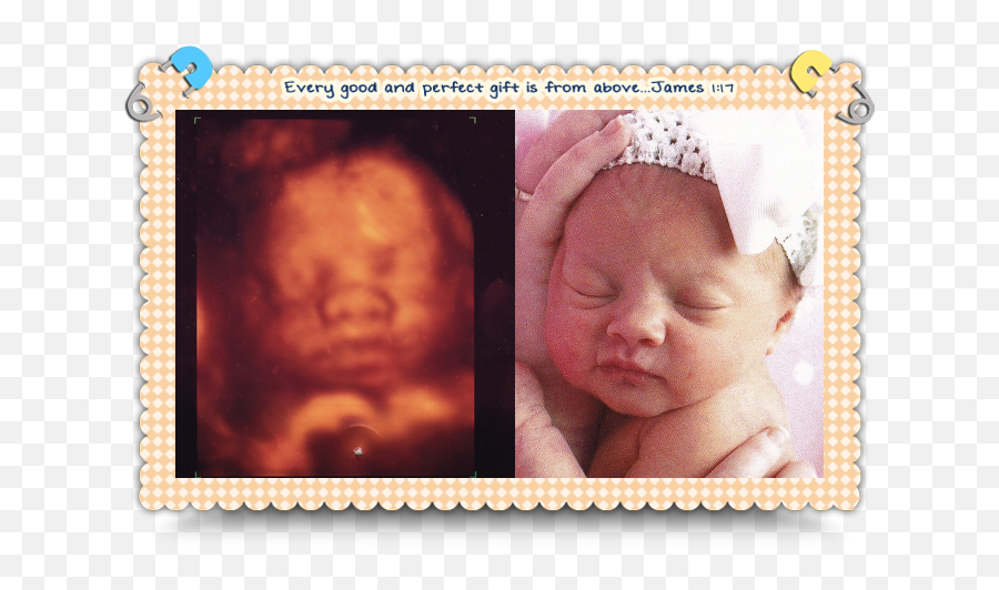 Download Hd Baby Piper - Baby Face 4d Ultrasound Transparent 4d Ultrasound And Baby Png,Baby Face Png
