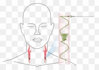 Javelin Medical About Vine - For Adult png