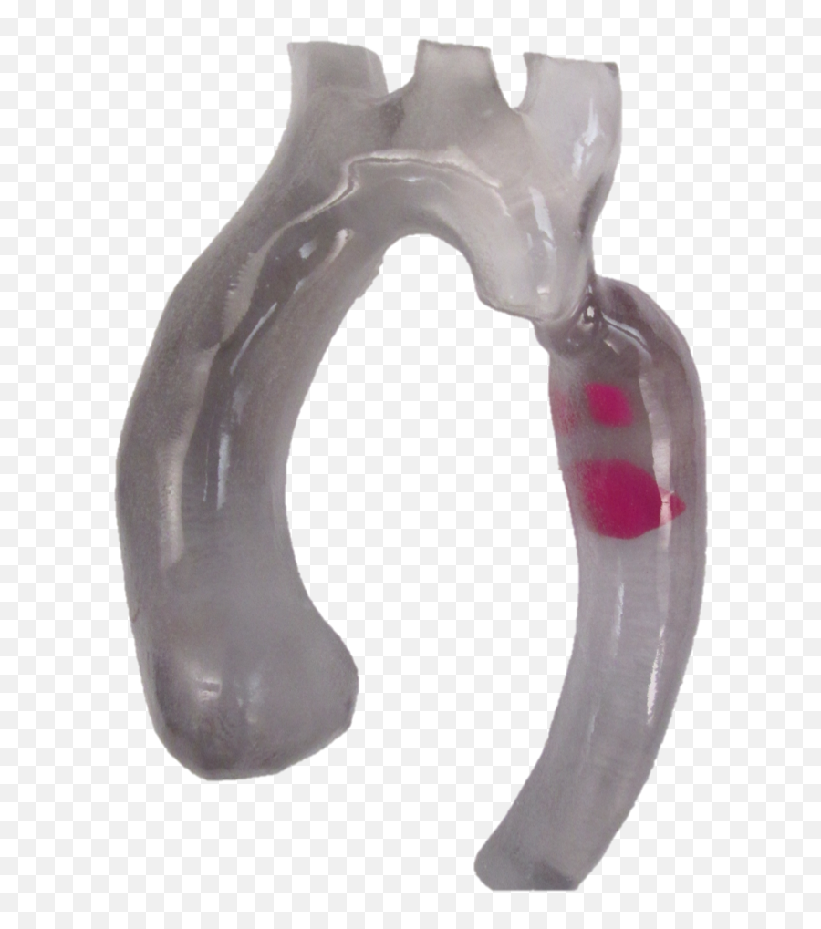 3d Printed Aortic Arch With - Diagonal Pliers Png,Arch Png
