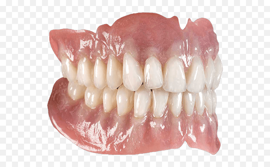 Implant Supported Dentures Los Angeles - Dentures Png,Dentures Png