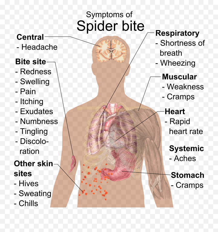 How To Identify Spider Bites Triangle Pest Control - Spider Bite Side Effects Png,Bite Mark Png