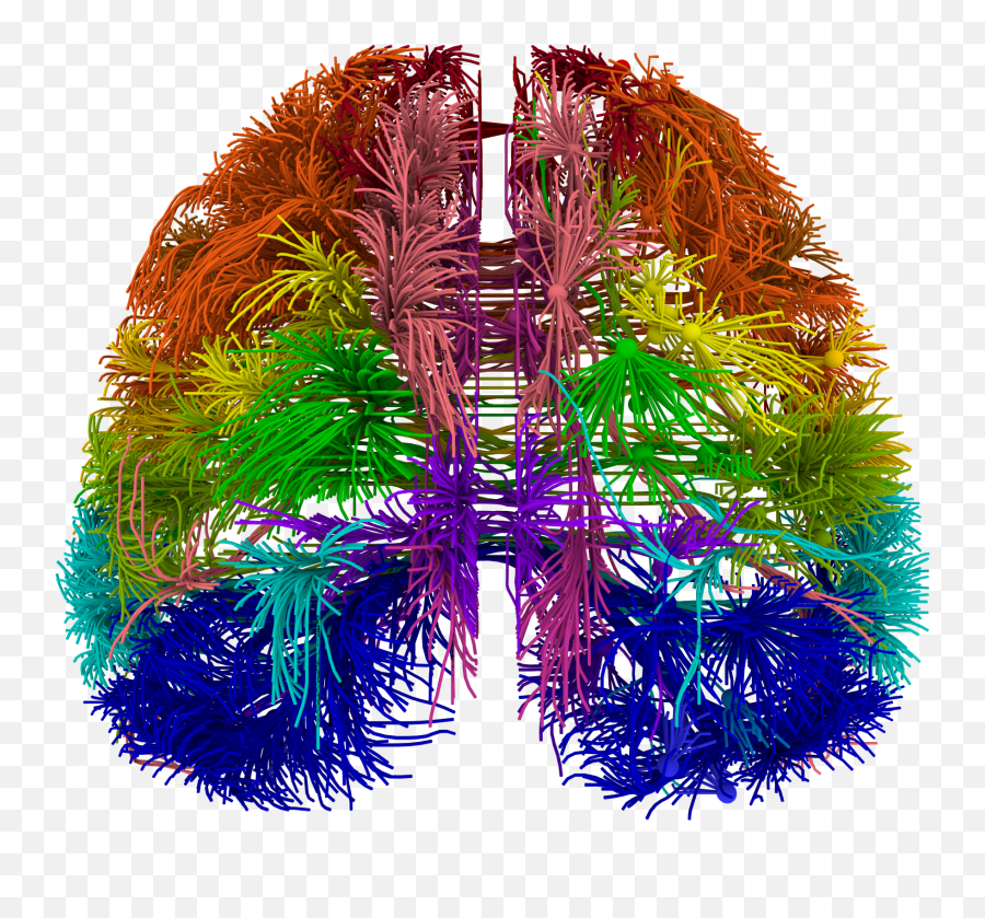 The Importance Of Connections Psychology Today Hong Kong - Brain Neuron Connections Png,Brain Transparent Image