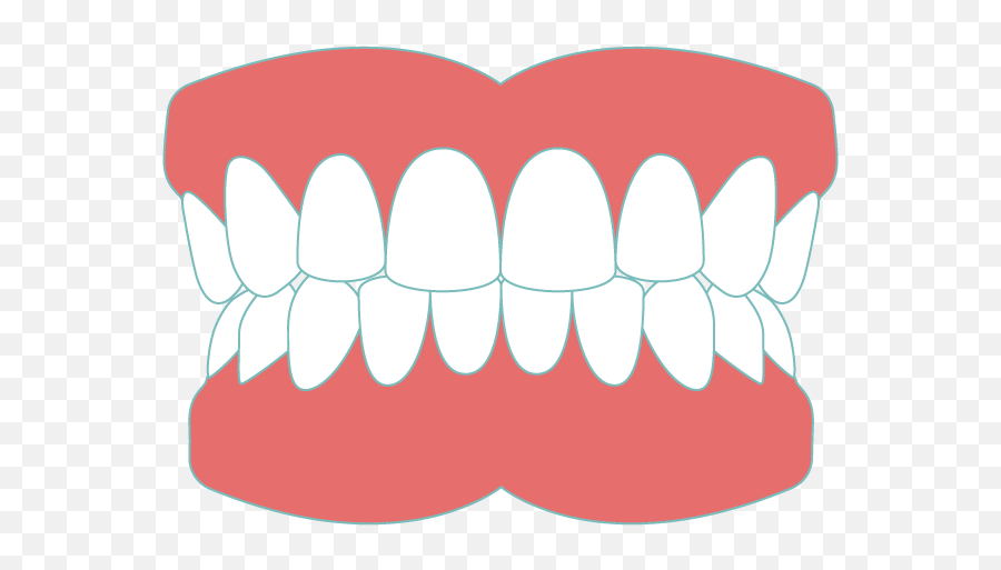 Dentures Sudbury Smiles Dentistry - Denture Clipart Png,Dentures Png.