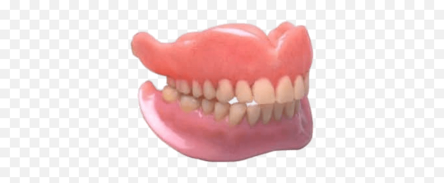Lower And Upper Denture Transparent Png - Partial And Full Denture,Dentures Png