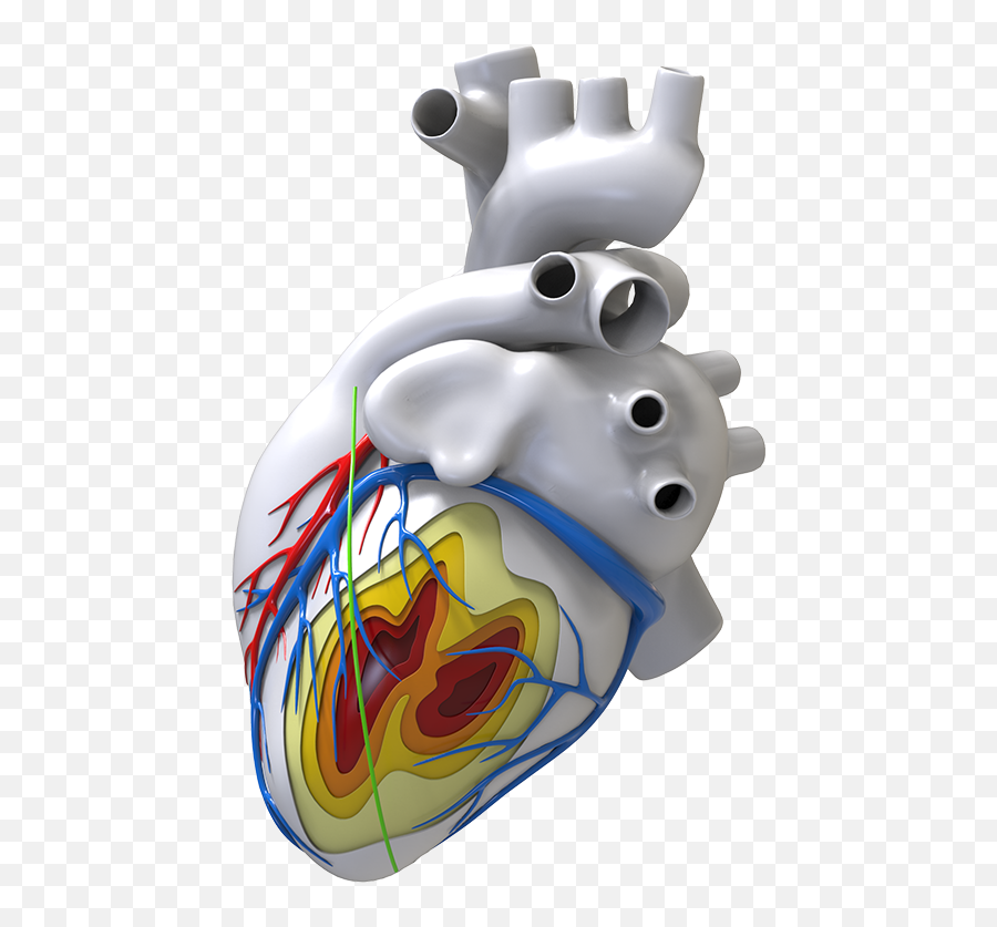 Inheart - Where Imaging Meets Cardiac Electrophysiology Illustration Png,Anatomical Heart Png