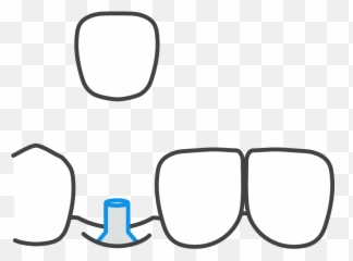 Ponte Vedra Family Dentistry 5 - Star png