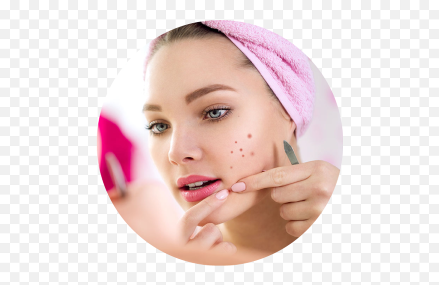 Pimple Removal Treatment In Trivandrum - Skin Treatment Png,Pimple Png