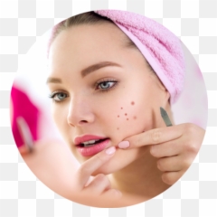 Pimple Removal Treatment In Trivandrum - Skin Treatment Png,Pimple Png