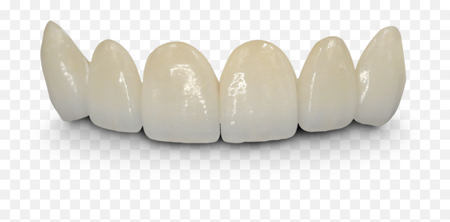 Teeth Png Hd - Bridge Teeth Png,Teeth Png