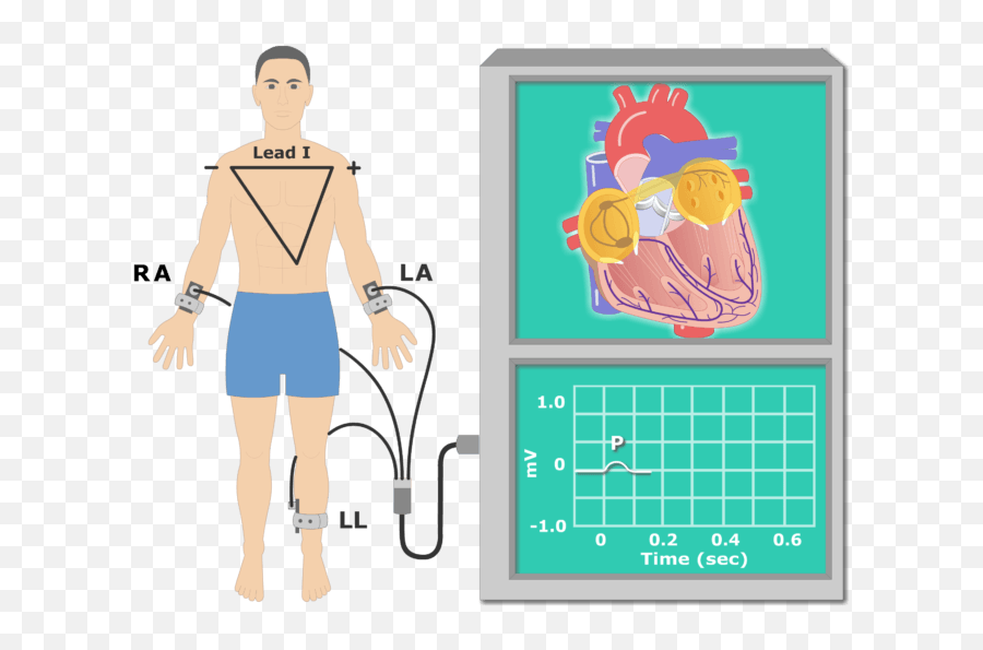 The Electrocardiogram Ekg Or Ecg - Ecg Clipart Png,Cartoon Wave Png