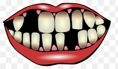 Download Smoking Clipart Smoke Effect - Effects Of Bad Teeth png