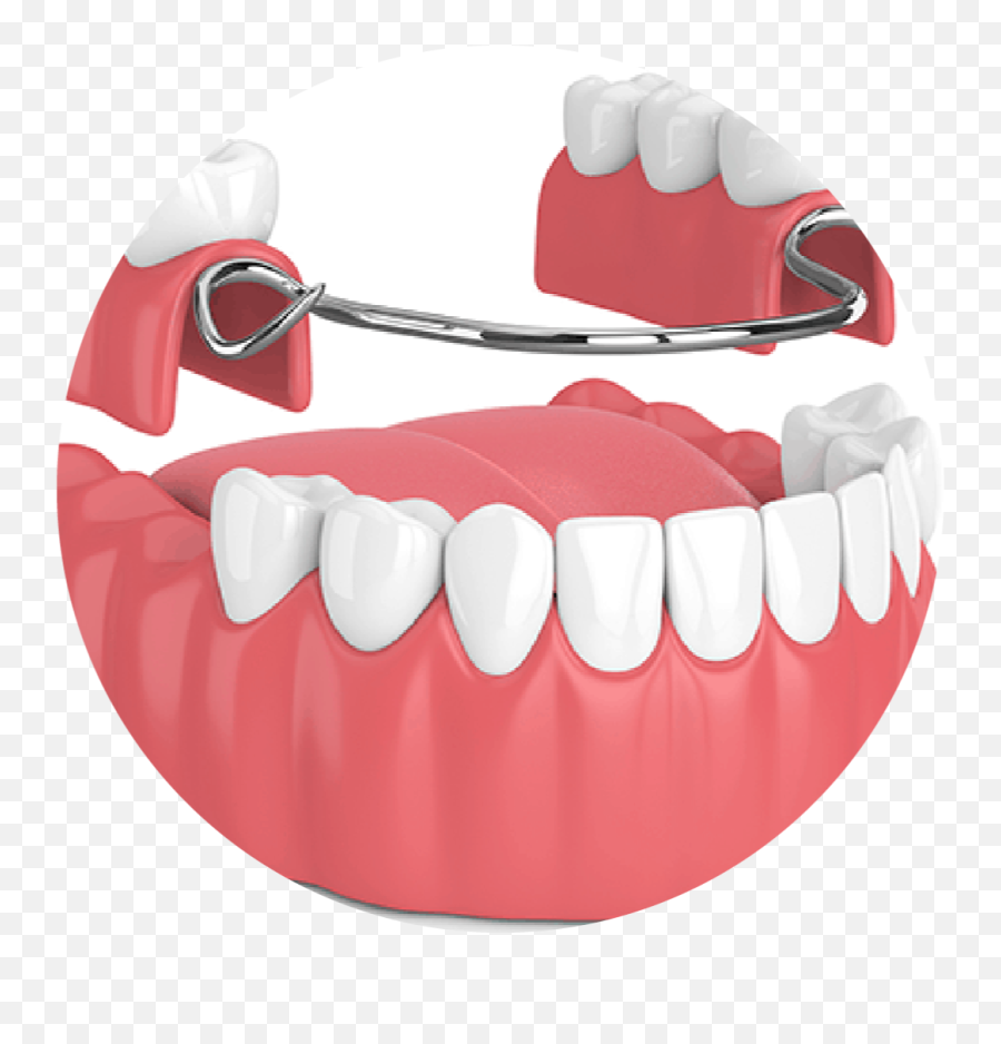 Full And Partial Dentures - Dental Denture Images Hd Png,Dentures Png