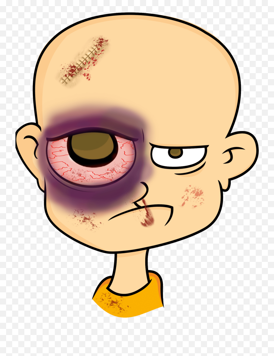 Eyebrow Clipart Eyelid - Man With Black Eye Cartoon Png,Eyelid Png