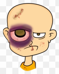 Eyebrow Clipart Eyelid - Man With Black Eye Cartoon Png,Eyelid Png