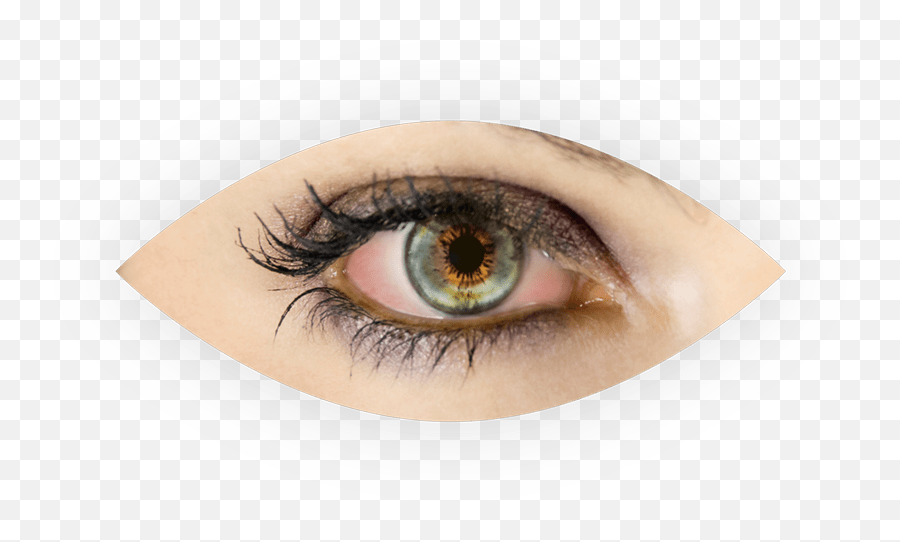 Dry Eyes - Eye Png,Eyelid Png