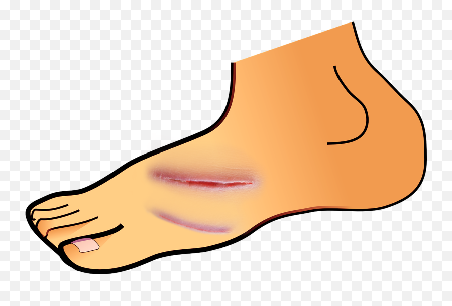Library Of Foot Cut Jpg Freeuse Stock - Foot Clipart Png,Cuts Png
