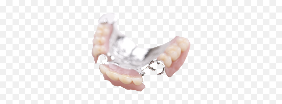 Partial Acrylic Dentures - Mesh On Partial Denture Png,Dentures Png