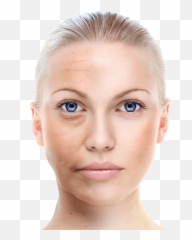 Facial Cupping Therapy Set - Skin Wrinkles Transparent Background png