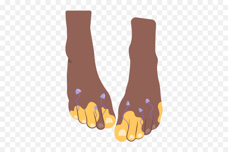 Tinea Pedis Athleteu0027s Foot Symptoms Treatment And - For Women Png,Furaffinity Icon Without Name