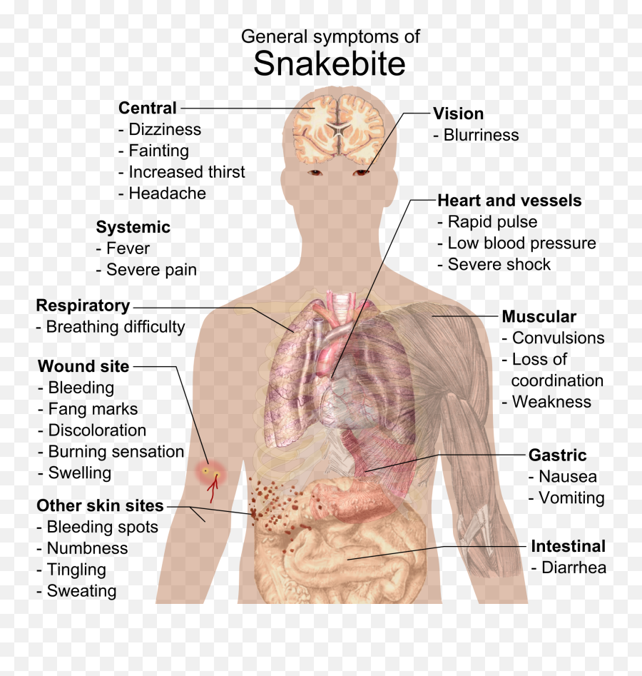 Filesnake Bite Symptomspng - Wikimedia Commons First Aid For Snake Bite,Scratch Marks Png