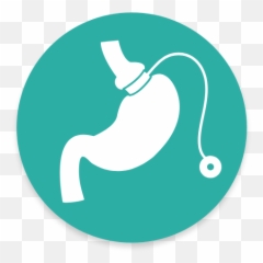 Gastric Banding Alexandria Natchitoches La - Language png