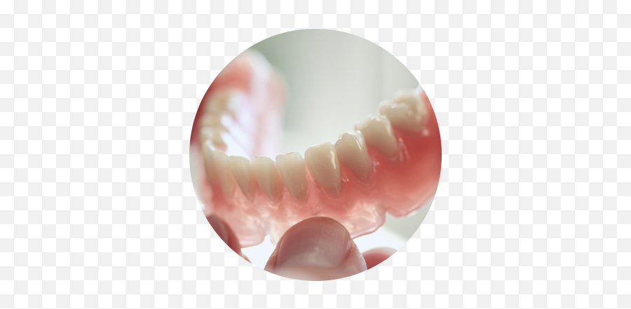 Partial Dentures - Artificial Tooth Png,Dentures Png