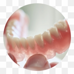 Partial Dentures - Artificial Tooth Png,Dentures Png