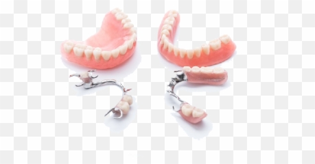 Partial Dentures - Cost Of Partial Dentures Png,Dentures Png