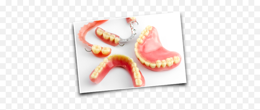 Dentures - Types Of Dentures Uk Png,Dentures Png