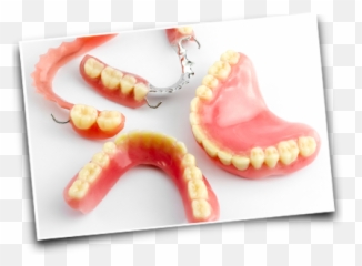 Dentures - Types Of Dentures Uk Png,Dentures Png
