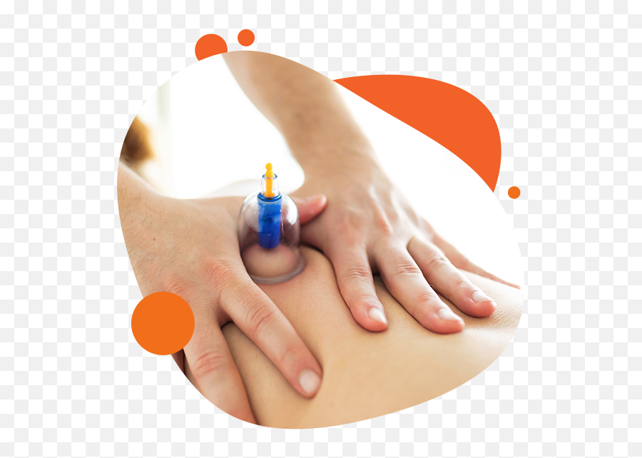 Cupping Synergy Physical Therapy - Nail Care Png,Cupped Hands Png