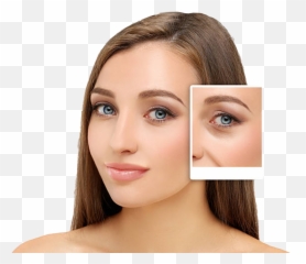 Eyelid Rejuvenation - Ct Mí Mtp Png,Eyelid Png