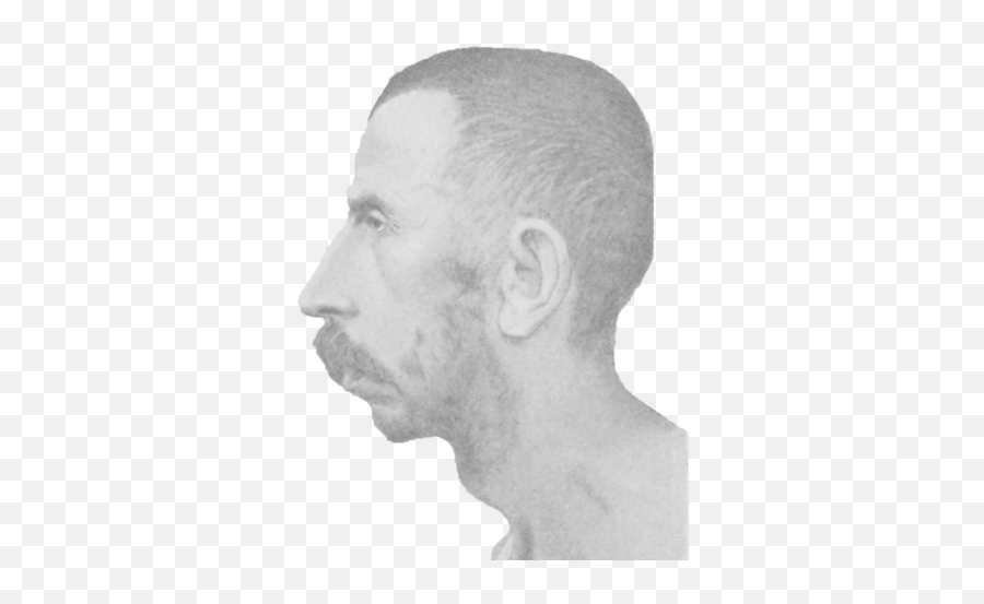 Schizophrenia Congenital Idiot - Face Profile Png,Idiot Png