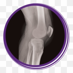 Download Photo Of An X - ray Knee Joint Rochelle Transparent Background png