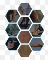 Download Fine Lines And Wrinkles Causes - Stress Testing In Risk Management png