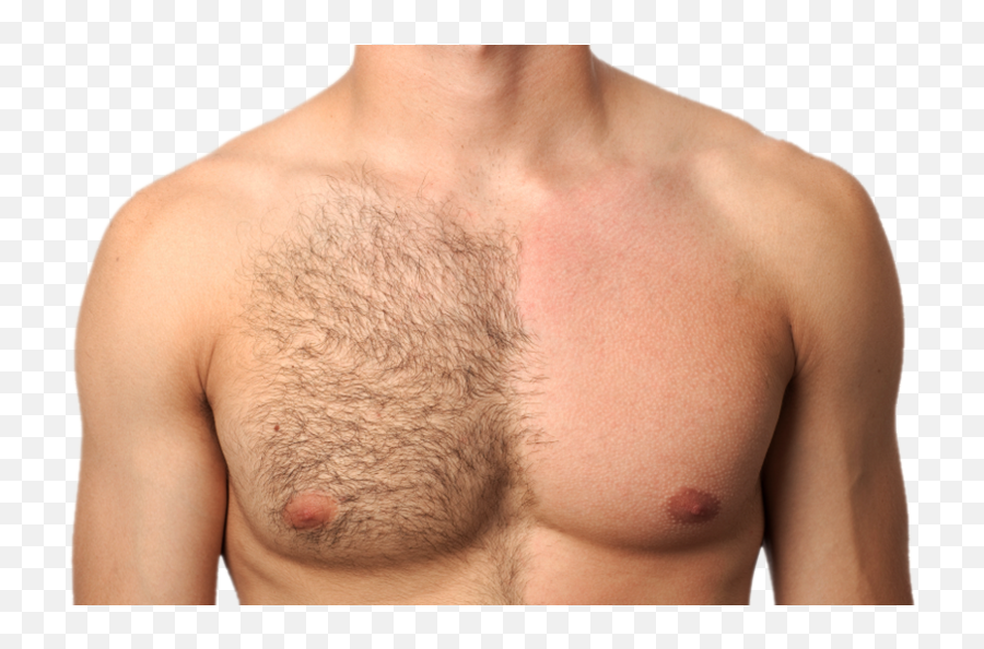 Best Hair Reduction Treatment In Bangalore And Hyderabad - Men Trimming Body Hair Png,Chest Hair Png