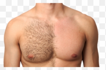 Best Hair Reduction Treatment In Bangalore And Hyderabad - Men Trimming Body Hair Png,Chest Hair Png