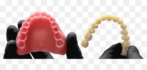 Envisiontec Avadent Join Forces - Dental Prothesis 3d Png,Dentures Png