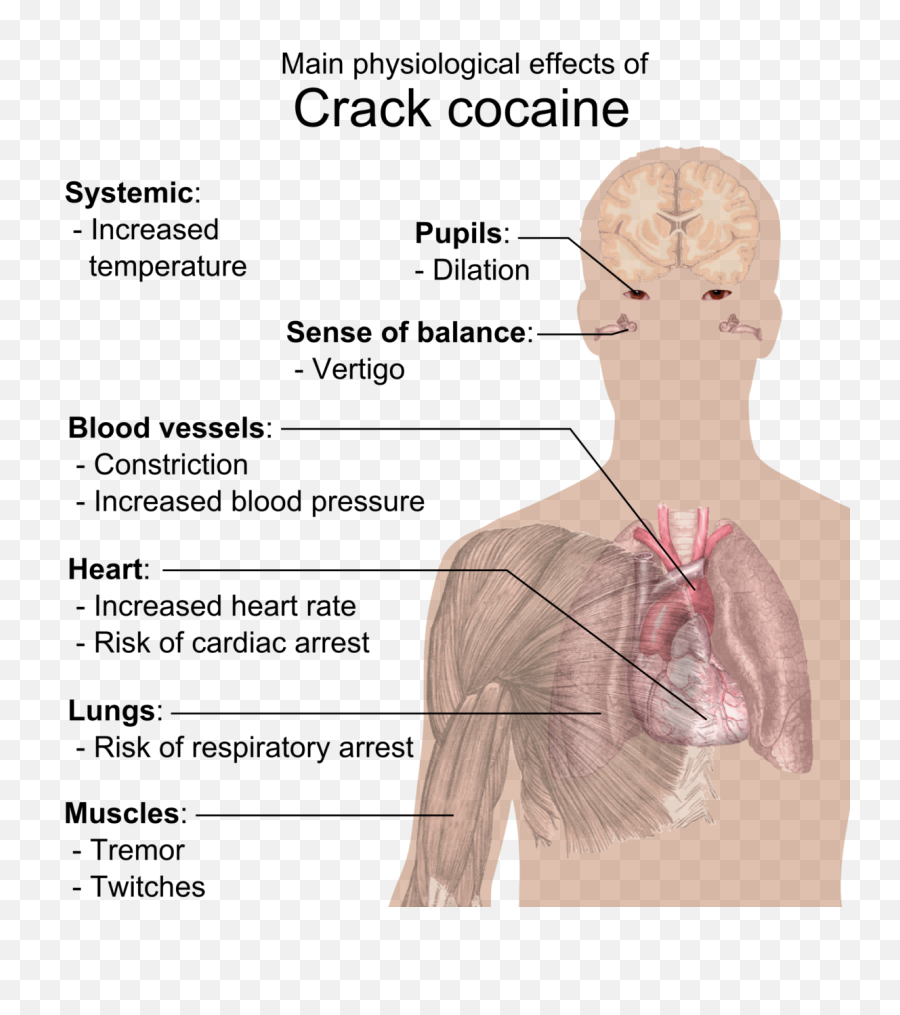 Crack Cocaine - Does Crack Do To The Body Png,Cocaine Png