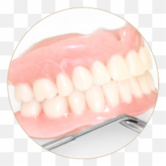 Dentures Complete U0026 Vancouver Coquitlam Da - Dentures Png,Dentures Png