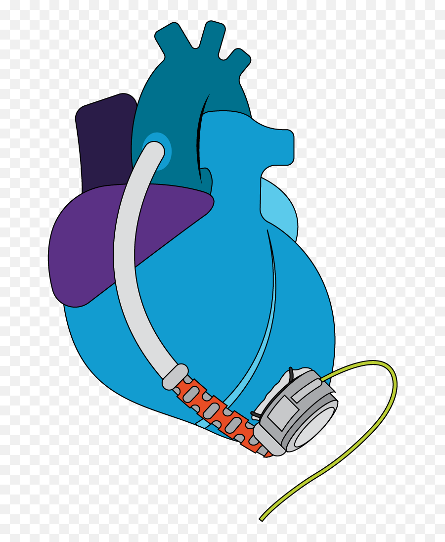 Ventricular Assist Device Icon - Drawing Png,Device Icon