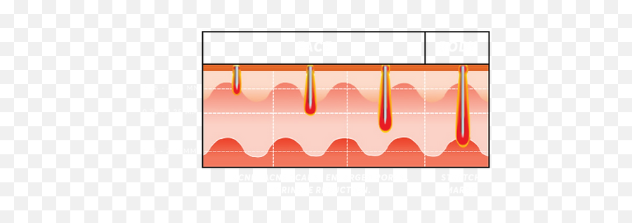 Mdrf Fractional Icon Aesthetics Site Png Laser Skin Treatment