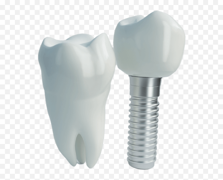 Blog New Horizon Institute - Solid Png,Dental Implant Icon